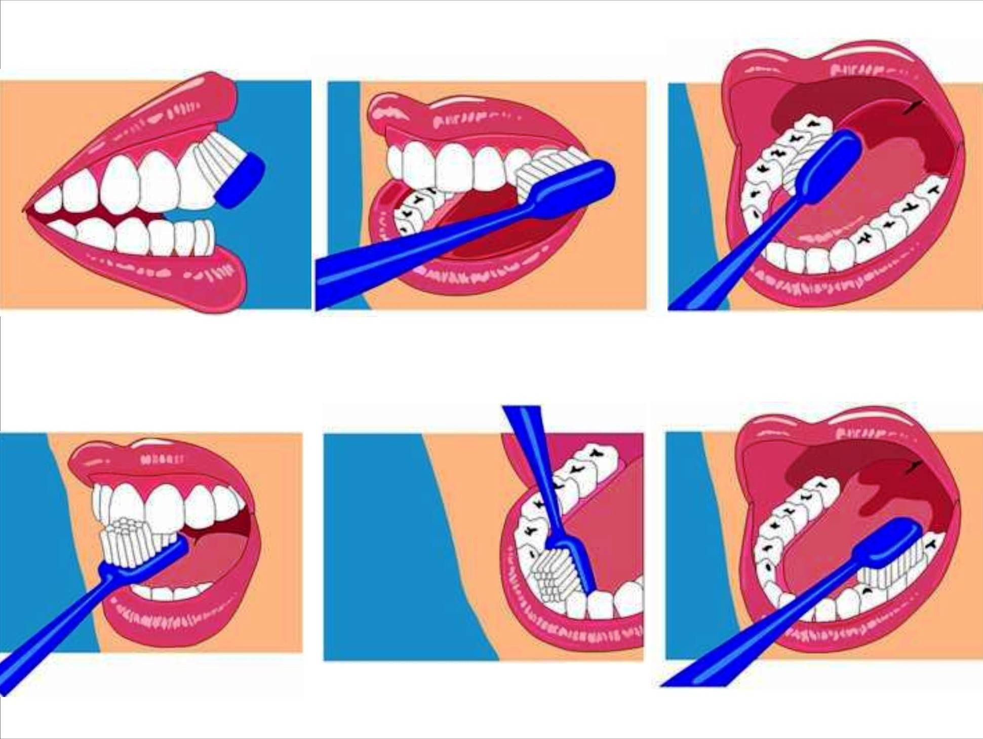 Чистить зубы во время поста. Схема как правильно чистить зубы для детей. Правельна схема чистки зубов. Правильная методика чистки зубов зубной щёткой. Гигиена зубов схема.